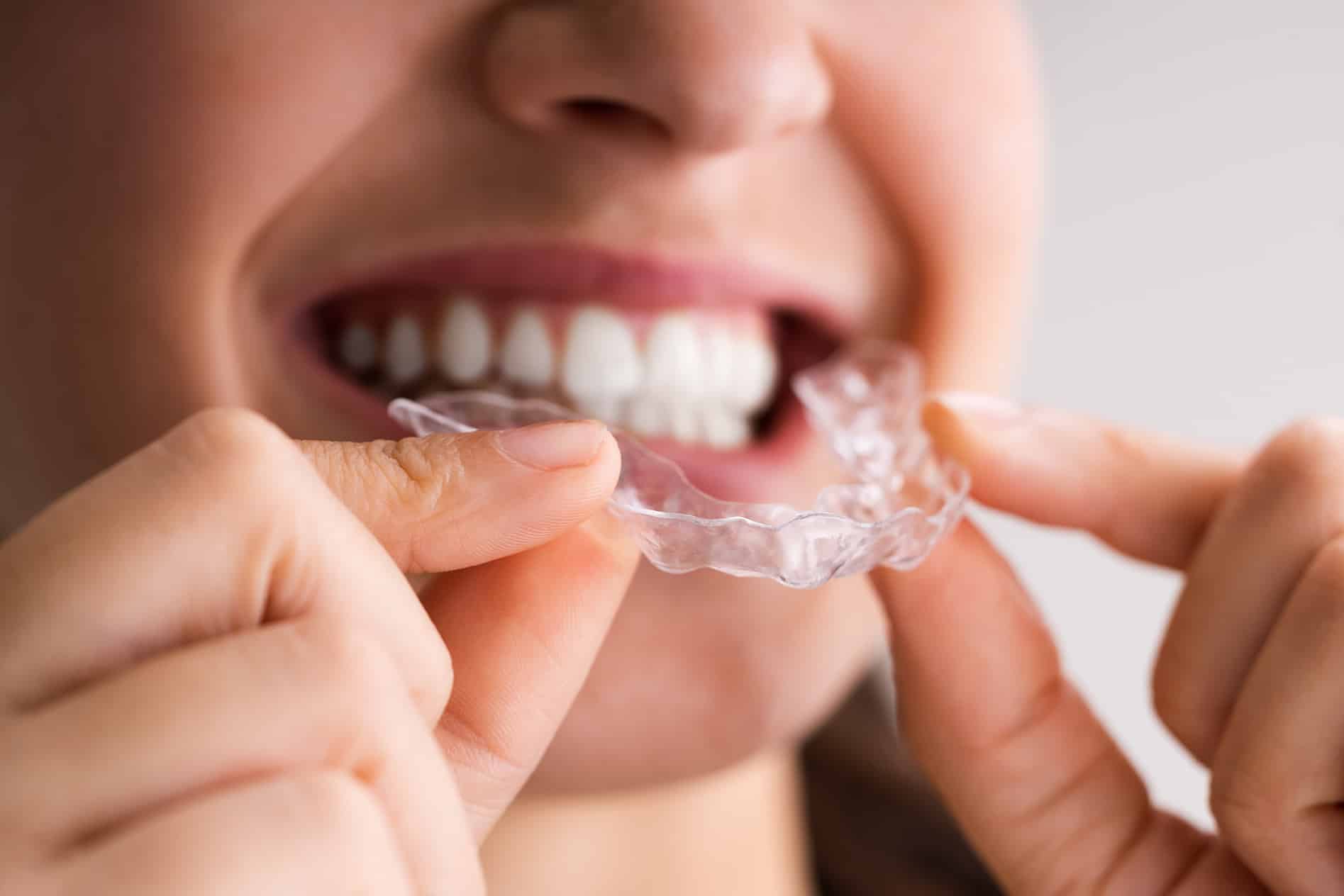 woman placing Clear Aligners on her teeth at Prosper Dental Studio in Cornelius, NC