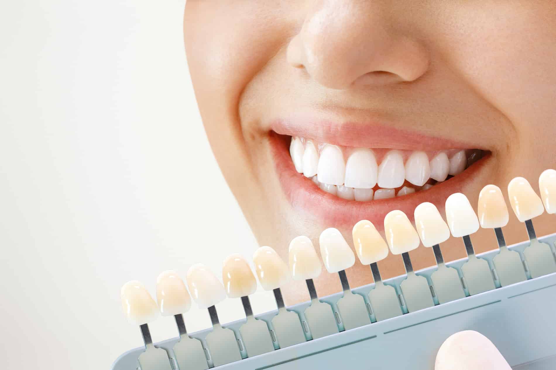 Woman at her professional teeth whitening appointment in Cornelius NC